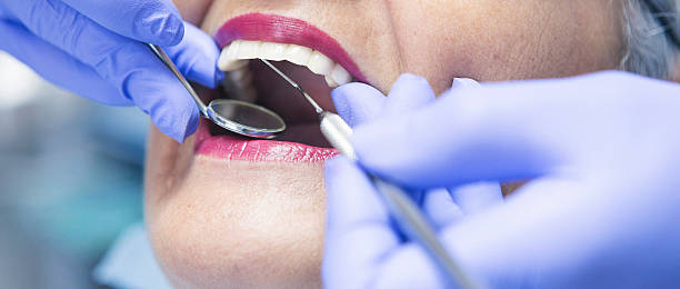 Trusted CA Emergency Dentist Experts